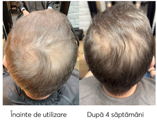 Sampon impotriva incaruntirii si caderii parului Ageless Clinic Shampoo Plus, Rut Hair, 300 ml