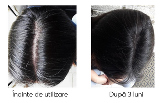 Sampon impotriva incaruntirii si caderii parului Ageless Clinic Shampoo Plus, Rut Hair, 300 ml