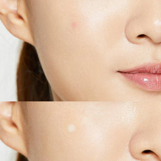 Plasturi hidrocoloidali impotriva acneei AC Collection,  COSRX, 26 buc