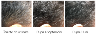 Sampon impotriva incaruntirii si caderii parului Ageless Clinic Shampoo Plus, Rut Hair, 370 ml