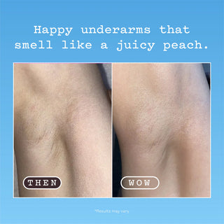 Before-and-after comparison of underarm hair reduction, with the left panel labeled 'THEN' showing more visible hair and the right panel labeled 'WOW' showing smoother skin, on a light blue background with text reading 'Happy underarms that smell like a juicy peach.'.