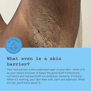 An informational graphic with a close-up of a textured skin barrier on a neck or shoulder, a blue circular 'Barrier Repair' icon, and a large light blue text block explaining skin barrier function.