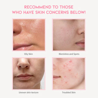 Ser cu niacinamide, #OOTD, 50 ml