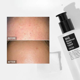 Solutie cu BHA impotriva punctelor negre,  COSRX, 100 ml